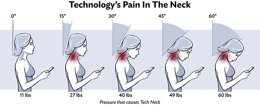 https://www.kort.com/why-choose-us/blog/physical-therapy-exercises-for-tech-neck-treatment/-/media/4f33a08d8a564f0f9f82bfce5cc1e180.ashx